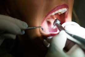 ΟΔΟΝΤΙΑΤΡΟΣ ΑΜΠΕΛΩΝΑΣ ΛΑΡΙΣΑ ΚΟΥΚΑΛΑΣ ΧΡΗΣΤΟΣ